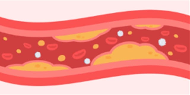 Cholesterol